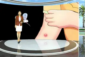 夏天有一种困扰是，蚊子怎么不叮别人，只追着我跑？视频封面