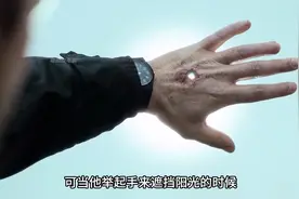 男人一觉醒来,意外发现手心中间出现一个大洞，太诡异了 ！