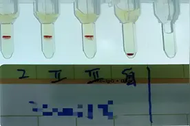 全球罕见！比“熊猫血”还稀有，云南文山首次发现罕见小p血型视频封面