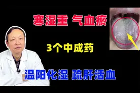 当舌头出现这些信号，寒湿，血瘀就找上门了，快看有没有你