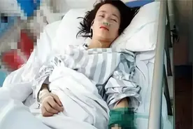 女学生饲养宠物蛇被咬进ICU，医生检查后倒吸一口凉气：这不是蛇