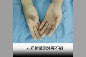 55岁大姐，经常晚上睡觉感觉手指麻木，不舒服图片