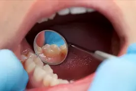 传播HIV的“体液”包含哪些？接触最应该注意什么？...图片