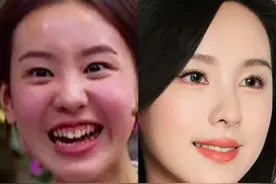 别光把肉毒素当除皱打了，肉毒素的【高阶妙用】！图片