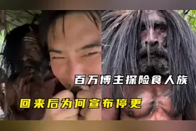 百万博主探险食人族，回来后竟宣布停更，眼里满是血丝全身蜕皮