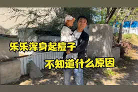 2周岁半小宝宝，身上突然长出红疙瘩，把小两口急坏了视频封面