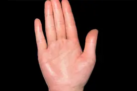 掌面色泽鲜红，流光溢彩，从手诊的角度来看，多注意身体的炎症