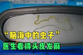 7岁女孩误食蝌蚪，四年后脑袋里的阴影，看得医生头皮发麻视频封面