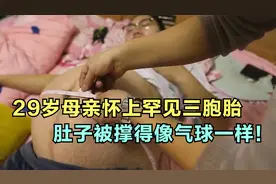 29岁母亲怀上罕见三胞胎，肚子被撑得像气球一样！结局让人感动视频封面