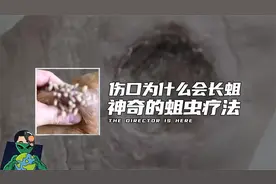 伤口为什么会长蛆？神奇的蛆虫疗法