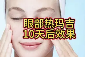 眼部热玛吉10天后效果、集美们有点牛啊~视频封面