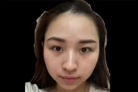 鼻高隆有肉，中年财运和夫运都不错视频封面