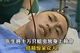 21岁小伙下身被烧焦，医生放十万蛆虫身上救命，一天吃掉5斤腐肉