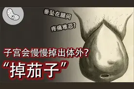 【子宫脱垂】会慢慢掉出体外？不生也有风险？雷区大盘点