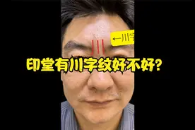 印堂有川字纹好不好？
