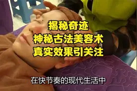 揭秘奇迹！神秘古法美容术，真实效果引关注！视频封面
