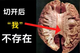 人类意识令人不安的真相 | 裂脑实验视频封面