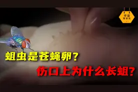 蛆虫并不是自生的，为何伤口上会长蛆？蛆虫竟能有效防止伤口腐烂