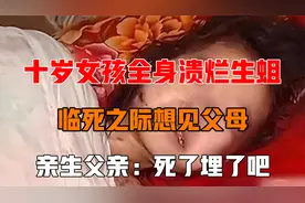 十岁女孩全身溃烂生蛆，临死之际想见父母，亲生父亲：死了埋了吧