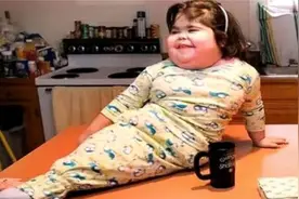 世界上真有美人鱼？女孩出生就长着“鱼尾巴”，网友：真不敢信视频封面