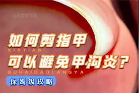 如何正确的剪指甲 #科普 #科学高光故事集