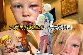 六岁男孩救妹妹，与恶狗搏斗。视频封面