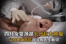 四月女婴颈部长出巨大肿瘤，父母跑遍各大医院，却没有医生敢切视频封面