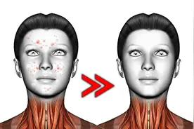 快速暴汗/疏通毛孔/改善爆痘最有效的训练视频封面