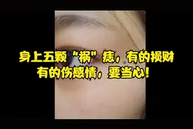 身上五颗“祸”痣，有的损财，有的伤感情，要当心！