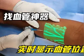 黑科技血管透视仪，能照遍身体上的血管，让护士打针百发百中视频封面