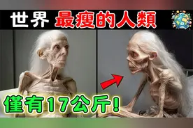 全世界最瘦的10个人类，第五名仅有35公斤，却貌美如同芭比娃娃视频封面
