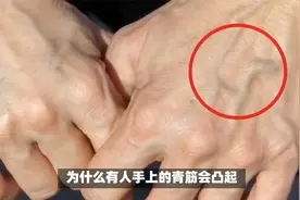 为啥有人手上的青筋会凸起？青筋多说明身体差？专家告诉你答案