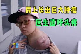 真实记录开颅手术全过程，全程不敢呼吸，医生太伟大了