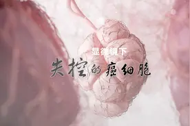 逐渐“失控”的癌细胞视频封面