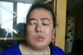 治面瘫效验方图片