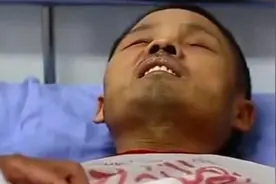 2015年医生打开男子腹腔，却看不见任何脏器，满满一肚子的癌细胞图片