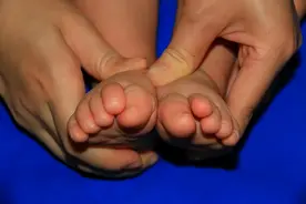 宝宝的脚趾重叠需要矫正吗？图片