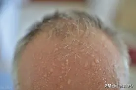 送你四种阴阳双补的中成药，帮你助阳、固本、补肾、填精图片