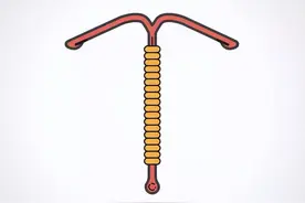 节育环不取出，会长到肉里吗？医生提醒：最佳取环年龄别超这个数图片