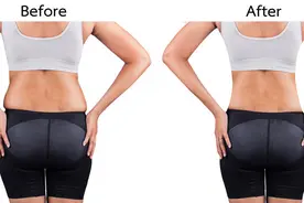 从59公斤到50公斤，逆转脂肪肝图片