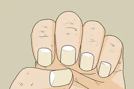 指甲是健康晴雨表，指甲上一个“月牙”都没有，代表什么意思？图片