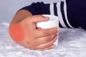 痛风不痛就是病好了吗？这3个降尿酸的方法，可能比吃药都有效图片