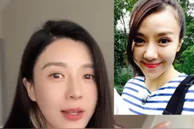 40岁女星承认整容！五官全动整完后脸肿似猪头，自曝后遗症太严重图片