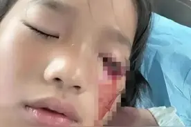 闹大了！江苏8岁女孩眼睛被弹弓打瞎后续：不立案、有免罪金牌！图片