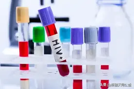 艾滋病“红点”皮疹具体是什么样子？图片