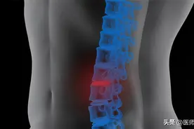 一年只要打一次的“唑来膦酸”，是抗骨质疏松神药？听医生怎么说图片