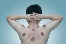 什么是“湿热”？身体出现这些湿热症状，该如何调理？一文科普！图片