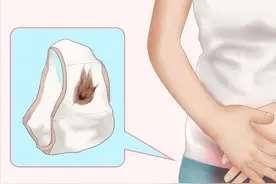 出现褐色分泌物是怎么回事？严重吗？图片