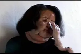 “整容上瘾”的韩慧景：从眉清目秀到电扇脸，付出惨痛代价图片