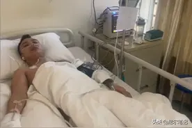 山东小伙上班6天遭核辐射感染，老板不赔偿拉黑跑路，已截肢出院图片